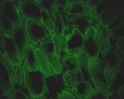 Dystrophin Antibody in Immunohistochemistry (Frozen) (IHC (F))