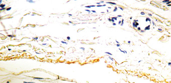 Elastin Antibody in Immunohistochemistry (Paraffin) (IHC (P))