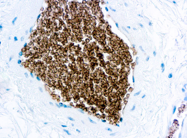 GYPC Antibody in Immunohistochemistry (Paraffin) (IHC (P))