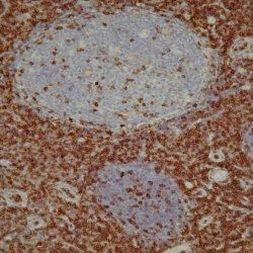 CD43 Antibody in Immunohistochemistry (Paraffin) (IHC (P))