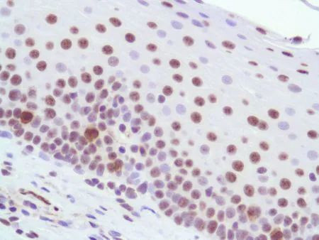 HMGN1 Antibody in Immunohistochemistry (Paraffin) (IHC (P))