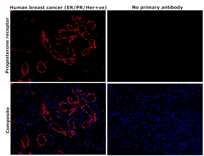 Progesterone Receptor Antibody in Immunohistochemistry (Paraffin) (IHC (P))