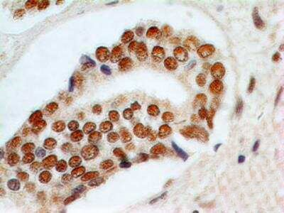 RAD9 Antibody in Immunohistochemistry (Paraffin) (IHC (P))