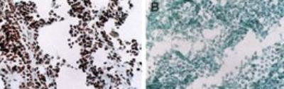 MYOD Antibody in Immunohistochemistry (Frozen) (IHC (F))