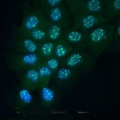 PARP1 (cleaved Asp214, Asp215) Antibody in Immunocytochemistry (ICC/IF)