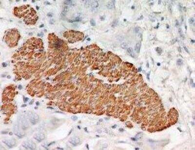 TRAF2 Antibody in Immunohistochemistry (Paraffin) (IHC (P))