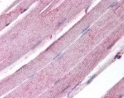Myogenin Antibody in Immunohistochemistry (Paraffin) (IHC (P))
