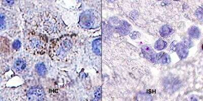 RANK Antibody in Immunohistochemistry (Paraffin) (IHC (P))