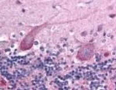 TEM7 Antibody in Immunohistochemistry (Paraffin) (IHC (P))