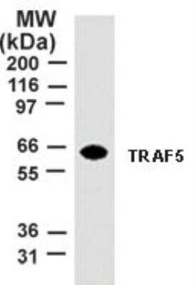 TRAF5 Antibody in Western Blot (WB)