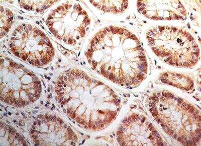 Bi-1 Antibody in Immunohistochemistry (Paraffin) (IHC (P))
