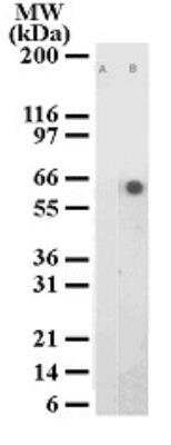 Phospho-ATF2 (Thr71) Antibody in Western Blot (WB)