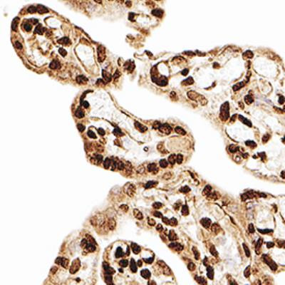 MBD3 Antibody in Immunohistochemistry (Paraffin) (IHC (P))