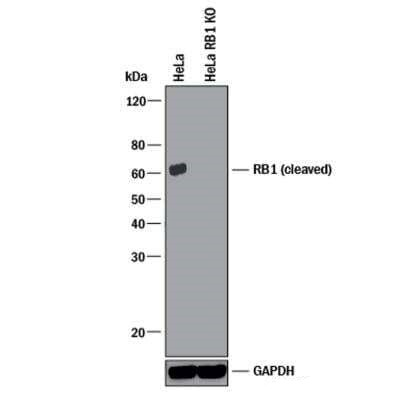 Rb (Cleaved DRb-p70) Antibody in Western Blot (WB)