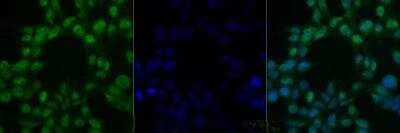 CHK2 Antibody in Immunocytochemistry (ICC/IF)