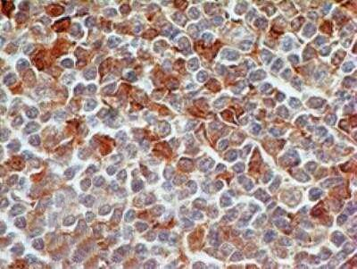 Caspase 7 Antibody in Immunohistochemistry (Paraffin) (IHC (P))