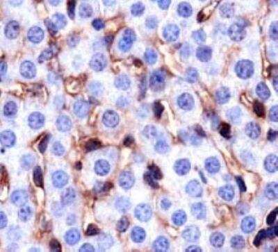 CD36 Antibody in Immunohistochemistry (Paraffin) (IHC (P))