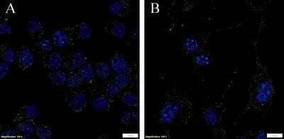 CD171 Antibody in Immunocytochemistry (ICC/IF)