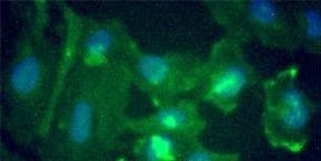 NAC1 Antibody in Immunocytochemistry (ICC/IF)