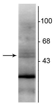 RXRB Antibody in Western Blot (WB)
