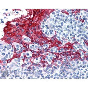 Cytokeratin 13 Antibody in Immunohistochemistry (Paraffin) (IHC (P))