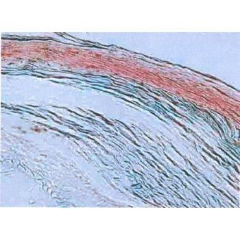 Hair Cortex Cytokeratin Antibody in Immunohistochemistry (Paraffin) (IHC (P))