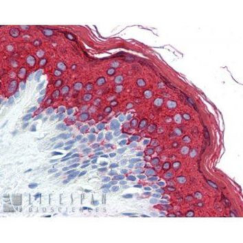Cytokeratin 10 Antibody in Immunohistochemistry (Paraffin) (IHC (P))