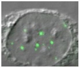 Gemin 3 Antibody in Immunocytochemistry (ICC/IF)