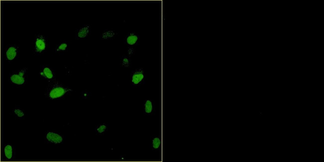 Bovine Papilloma Virus Type 1 E2 Antibody in Immunocytochemistry (ICC/IF)