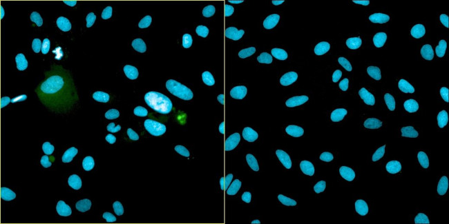 Bovine Papilloma Virus Type 1 E2 Antibody in Immunocytochemistry (ICC/IF)
