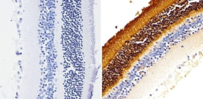 Rhodopsin Antibody in Immunohistochemistry (Paraffin) (IHC (P))