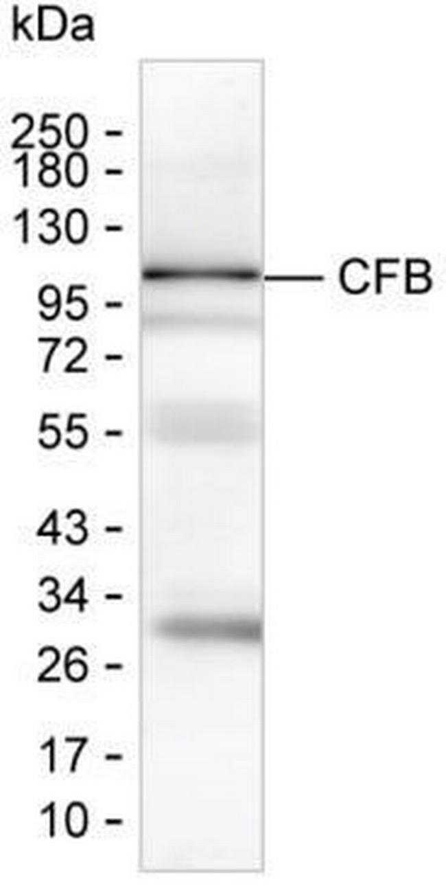 Complement Factor B Antibody in Western Blot (WB)