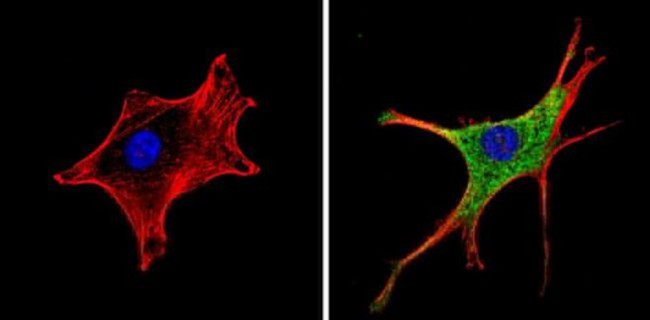 RARA Antibody in Immunocytochemistry (ICC/IF)