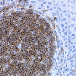 CD19 Antibody in Immunohistochemistry (Paraffin) (IHC (P))