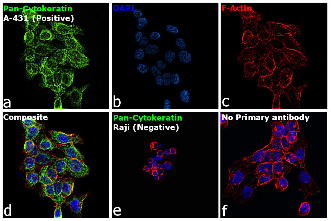 Cytokeratin Pan Type I/II Antibody in Immunocytochemistry (ICC/IF)