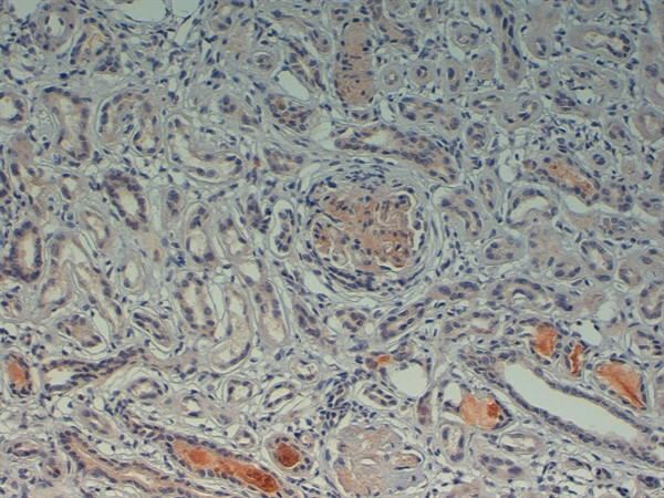 Complement C4d Antibody in Immunohistochemistry (Paraffin) (IHC (P))