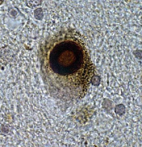 alpha Synuclein Antibody in Immunohistochemistry (IHC)