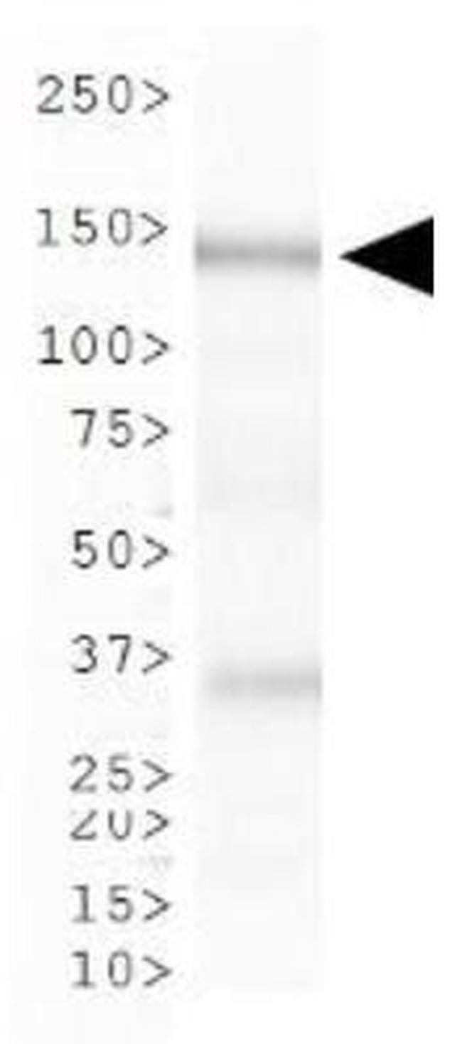 CAF1 p150 Antibody in Western Blot (WB)