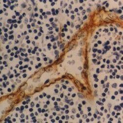 Thrombomodulin Antibody in Immunohistochemistry (Paraffin) (IHC (P))