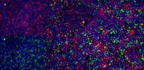 ITGA4 Antibody in Immunohistochemistry (Frozen) (IHC (F))