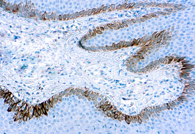Cytokeratin 15 Antibody in Immunohistochemistry (Paraffin) (IHC (P))