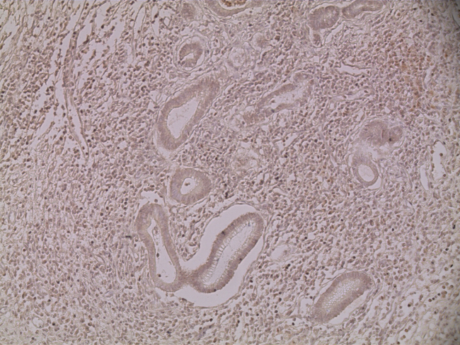 Cytokeratin 15 Antibody in Immunohistochemistry (Paraffin) (IHC (P))