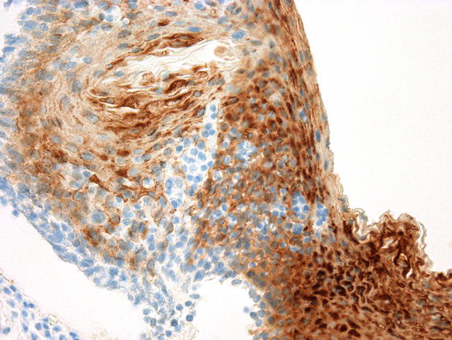 Cytokeratin 13 Antibody in Immunohistochemistry (Paraffin) (IHC (P))