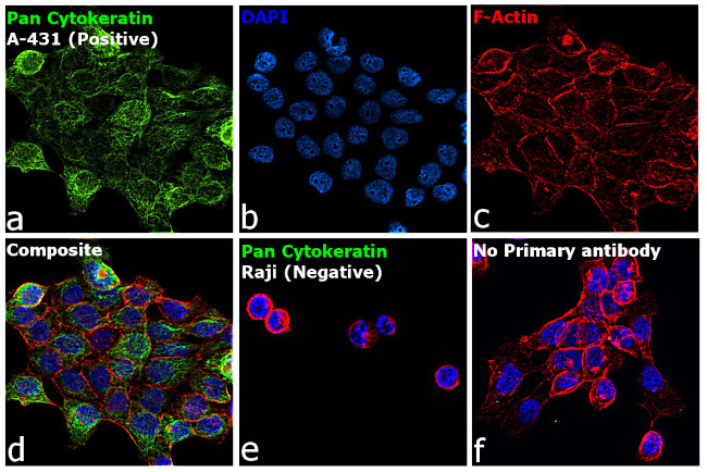 Cytokeratin Pan Antibody in Immunocytochemistry (ICC/IF)