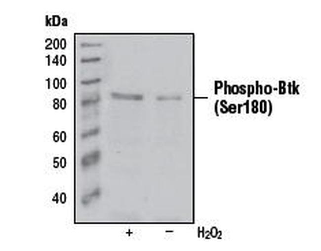 Phospho-Btk (Ser180) Antibody in Western Blot (WB)