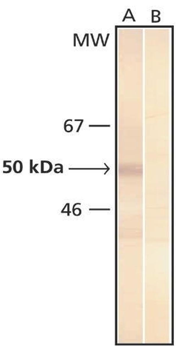 Phosphoserine Antibody in Western Blot (WB)