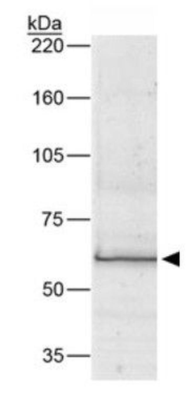 Bestrophin 1 Antibody in Western Blot (WB)