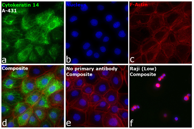 Cytokeratin 14 Antibody in Immunocytochemistry (ICC/IF)