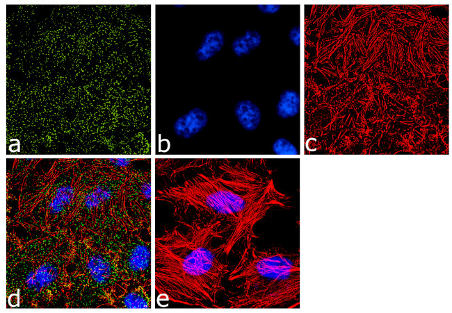 alpha Adaptin Antibody in Immunocytochemistry (ICC/IF)