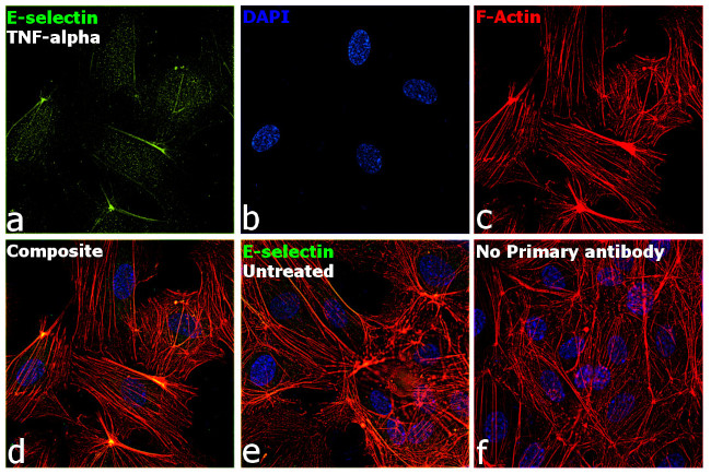 E-selectin Antibody in Immunocytochemistry (ICC/IF)